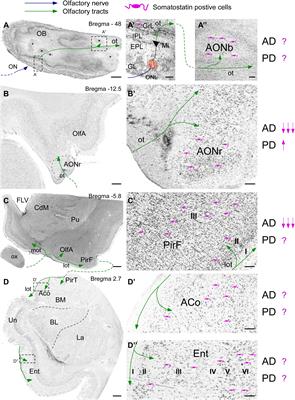 Somatostatin, Olfaction, and Neurodegeneration